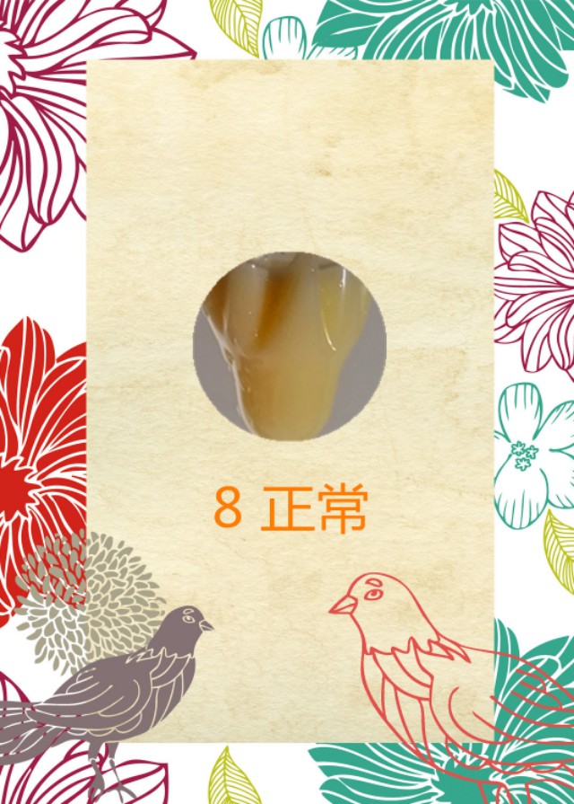 你的Jing液颜色，正常吗？