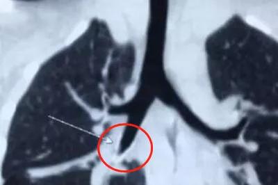 儿童奇事,奇闻奇事小孩