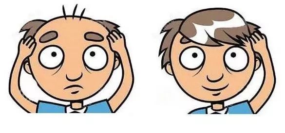 头发种植手术是如何种植的,头发种植利弊有哪些呢