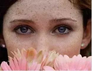 常见皮肤色斑有哪些怎么鉴别,面部色斑的鉴别诊断视频