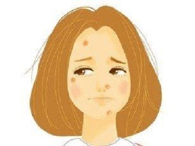 皮炎为什么这么难好,怎样分别急性皮炎和慢性皮炎