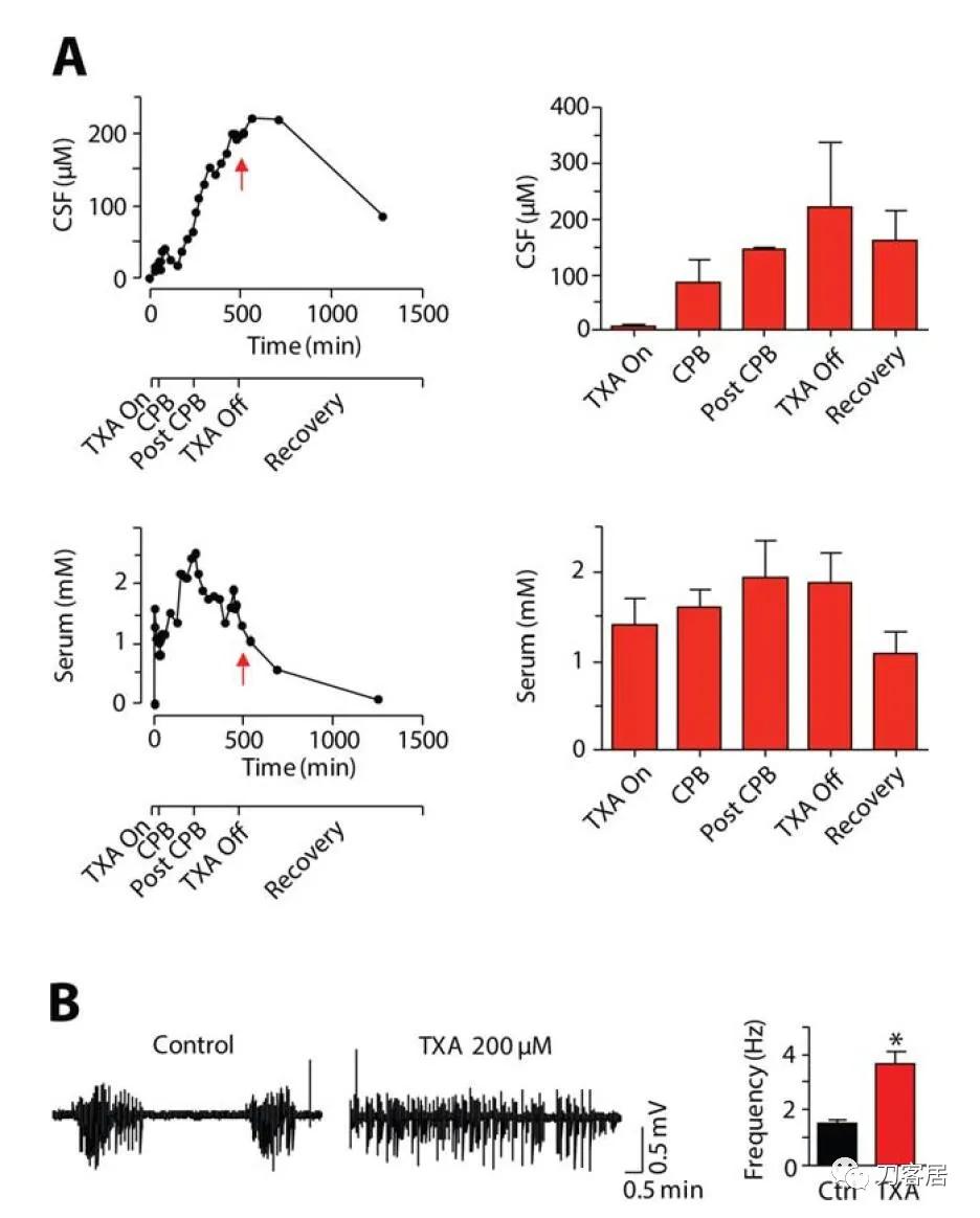 氨甲环酸是禁用药吗,氨甲环酸专家共识