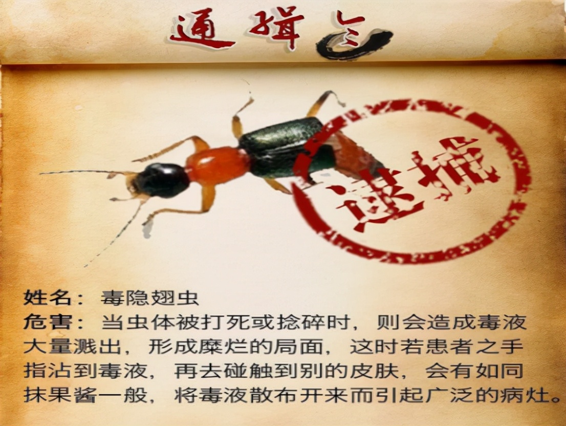 被隐翅虫毒液沾到涂什么药膏,被隐翅虫咬伤特效药