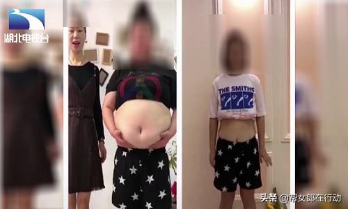 天然无副作用?女大学生“海淘”*肥药减**,四天后心脏衰竭