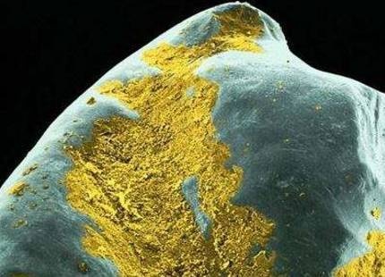 洗牙的过程是怎样的？洗牙有哪些注意事项呢？