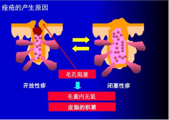 浠欎汉鎺岀棙鑲屼慨鎶よ啅,鐪嬪畬鐥樼棙浠ュ悗鎰熻鏇翠弗閲嶄簡