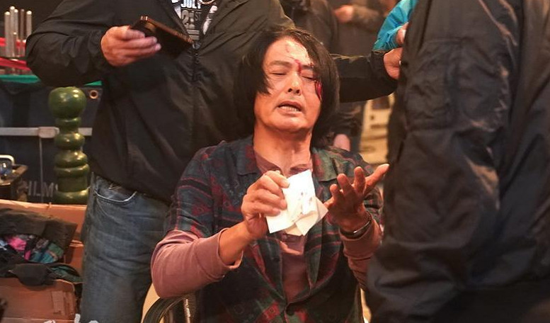 baby跑男口红,跑男中的baby受伤的视频