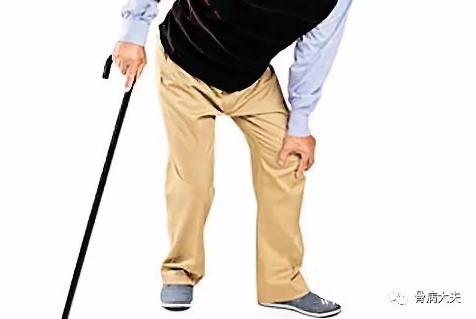 求问中医下肢无力是什么原因,双腿外侧怕冷是股骨头坏死吗