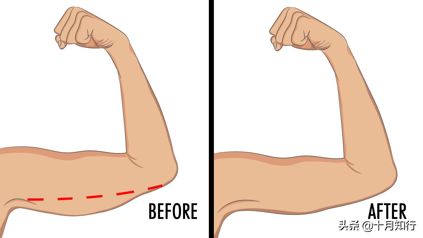 手臂拜拜肉松弛怎么塑形,大手臂粗怎么减拜拜肉