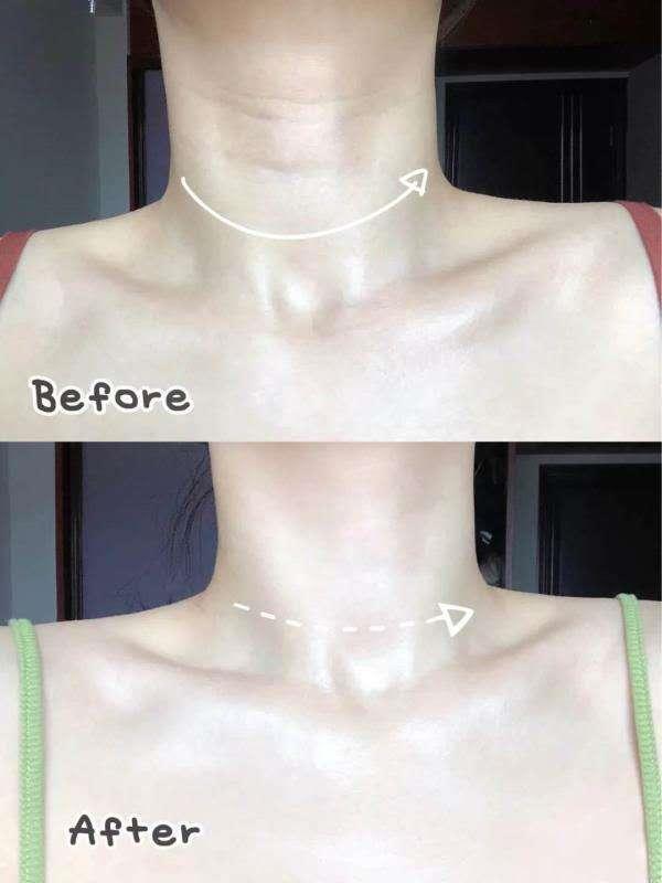 抗衰老蜗牛,蜗牛护肤品抗皱抗衰老