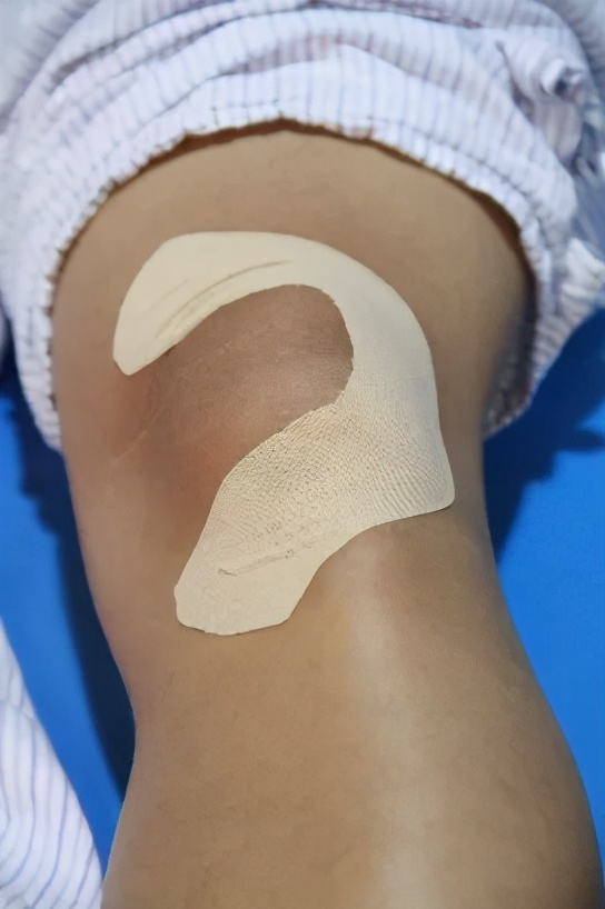 弹性贴布的原理,弹性贴布的作用