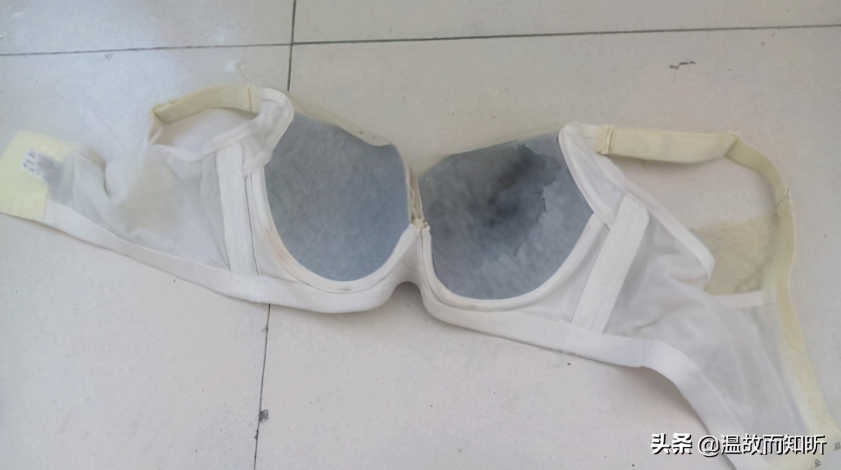 “不期而至”的乳头溢液,我该爱你还是恨你?