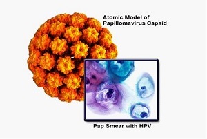 不做检查，怎样才能知道自己得了宫颈癌？