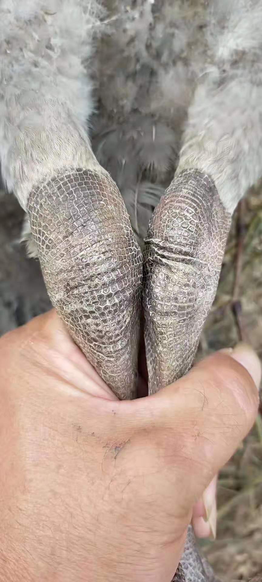 脚掌滑囊炎症状及治疗方法,脚踝滑膜囊积液怎么治疗