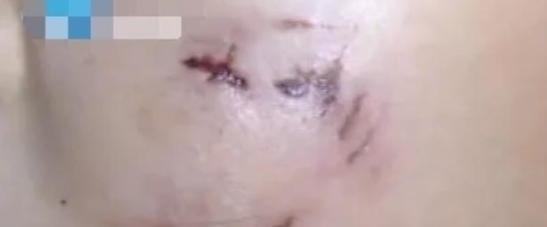 只要狗狗没有狂犬被咬也没事吧,狗狗打疫苗了被咬有事吗