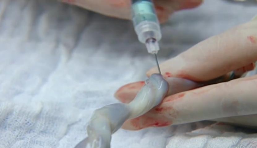 人造子宫实现让人类复活,人类能接受人造子宫吗