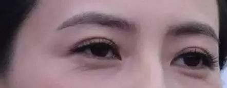 眼部常见问题有哪些,常见眼部问题