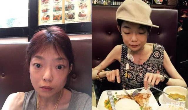 被豪门抛弃：昔日的22岁嫩模为取悦丈夫吃*肥药减**竟瘦成“纸片人”