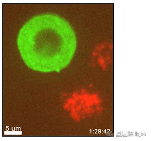 艾滋病病毒入侵全过程曝光,世界上被证实的艾滋病毒体外感染