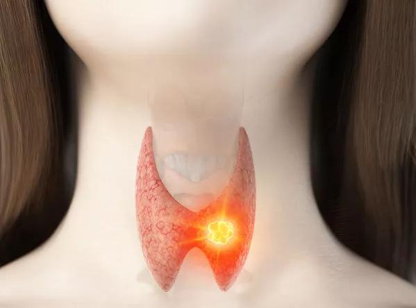 体检查出9种病多数不用治,体检查出这10种病基本不用治