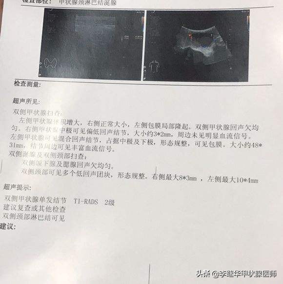 甲状腺结节良恶性鉴别方法,甲状腺结节恶性5类严重吗