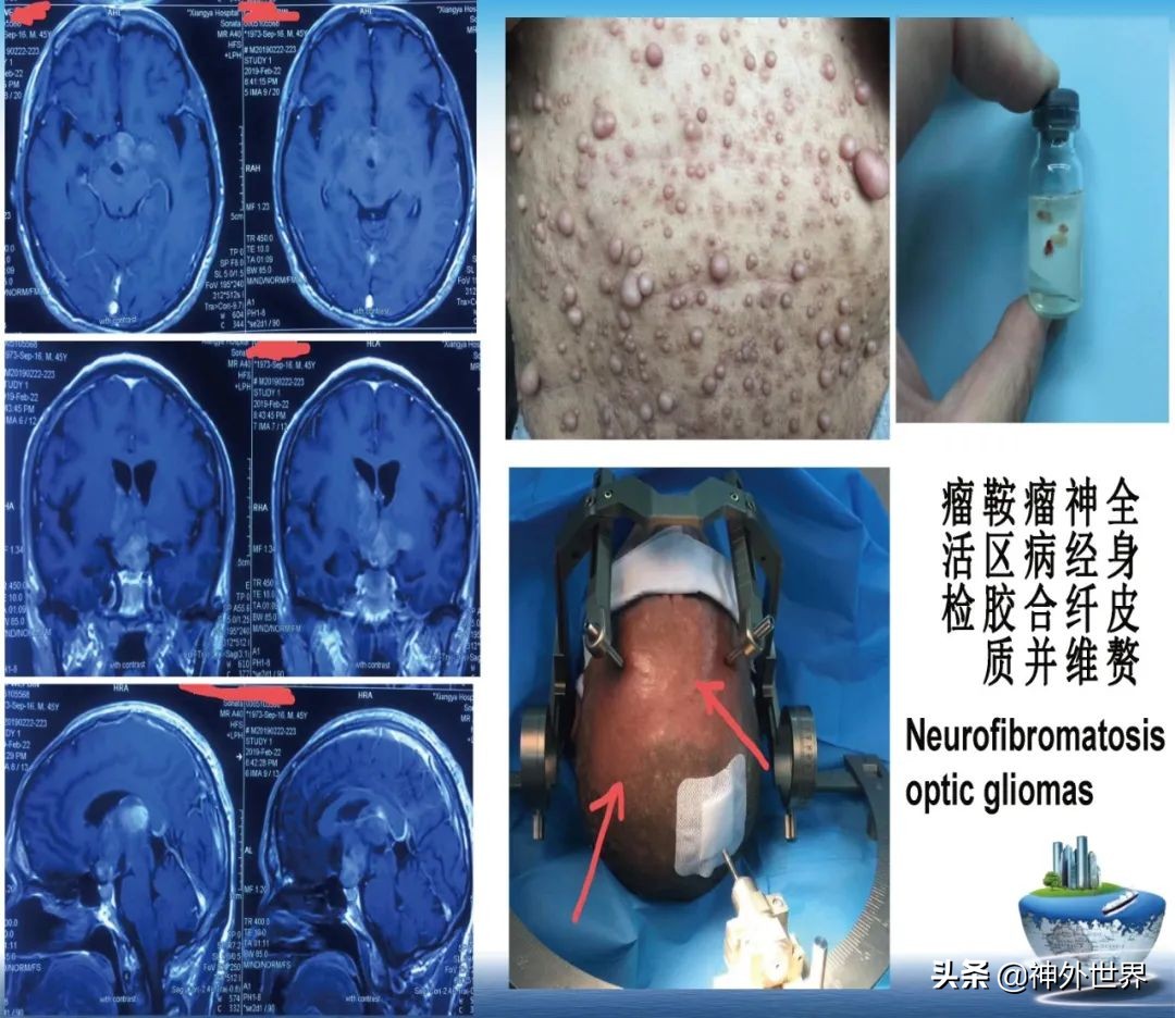 宣武医院神经外科王亚明祖籍,北京宣武医院神经科专家王亚明
