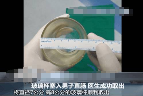 肛门塞异物很刺激？医生忙说：别乱来，快感之后全是悲伤