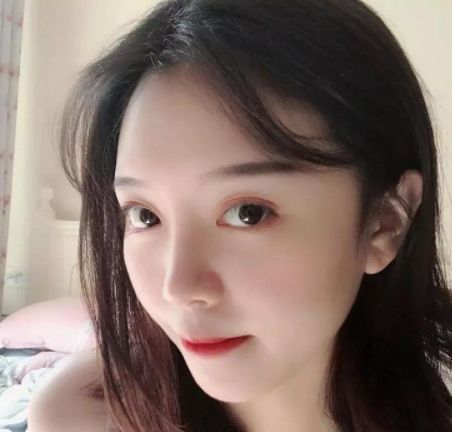 隆鼻成功案例小翘鼻,韦敏鼻综合