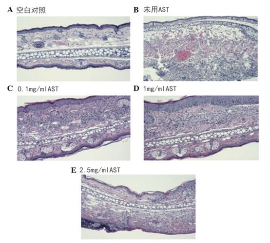 虾青素抗氧化第一名,虾青素地表最强抗氧化剂