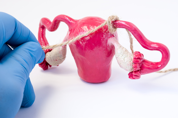 切除子宫以后还能运动吗,切除子宫后要做盆底康复吗