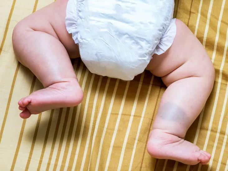 新生宝宝的这些现象令人担忧？有些不必担心，但有些一定要注意