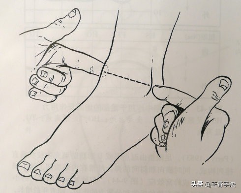 踝关节正骨复位手法,踝关节脱位怎么推拿按摩正骨