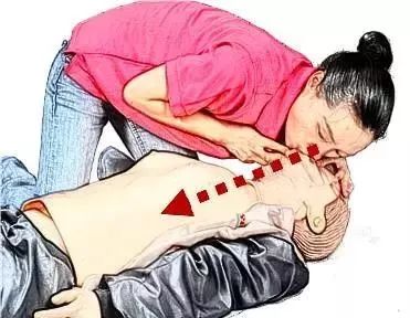 4岁女童掉进泥水坑4分钟后才被家长发现，溺水急救该怎么做？