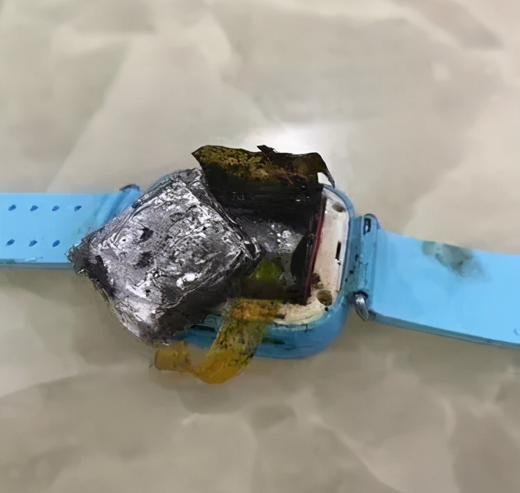 儿童电话手表为什么会烧伤,电话手表爆燃烧伤女童