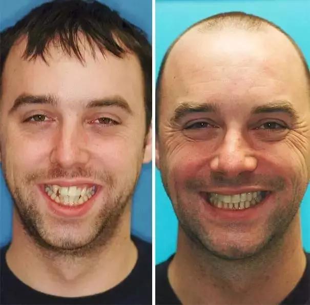 澶栧浗浜烘暣鐗欐晥鏋滃浘,闆呮偊榻跨绉嶇墮