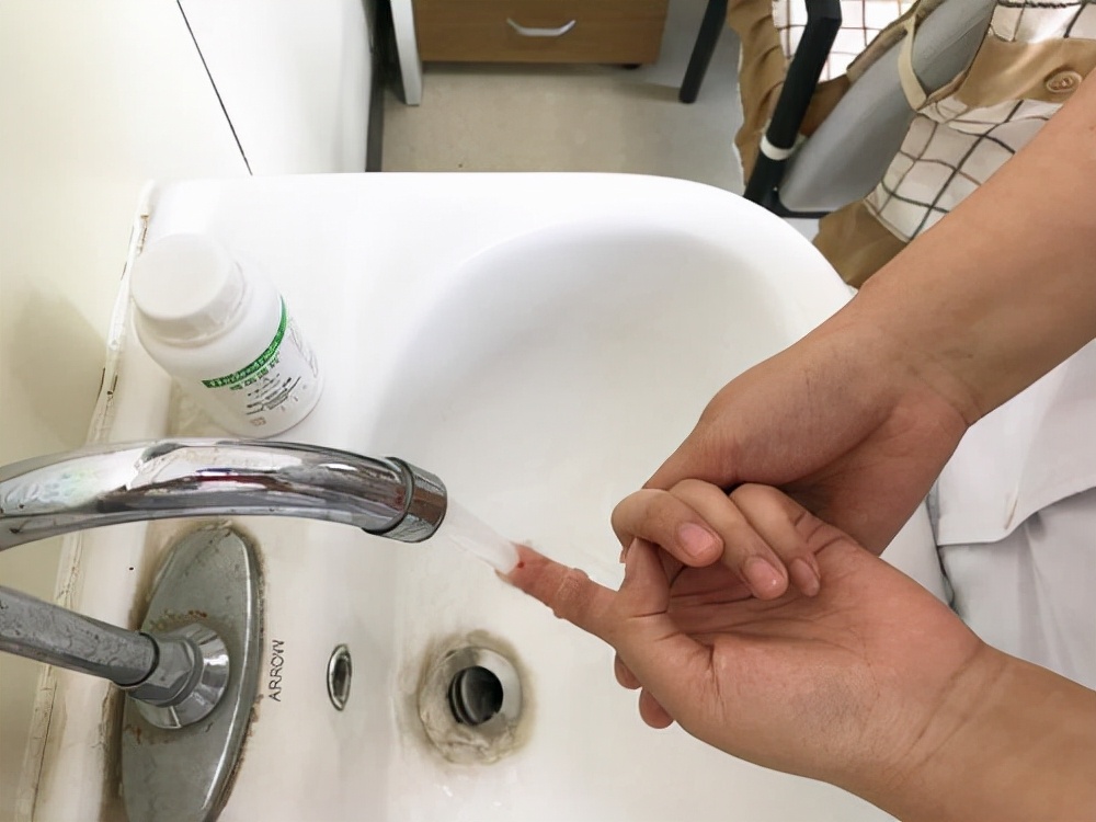 被狗咬伤后打狂犬疫苗就没事了吗,被狗咬伤打狂犬病疫苗后还有事吗