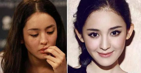 vc377美白淡斑精华旗舰店套装,BellaAurora美白精华