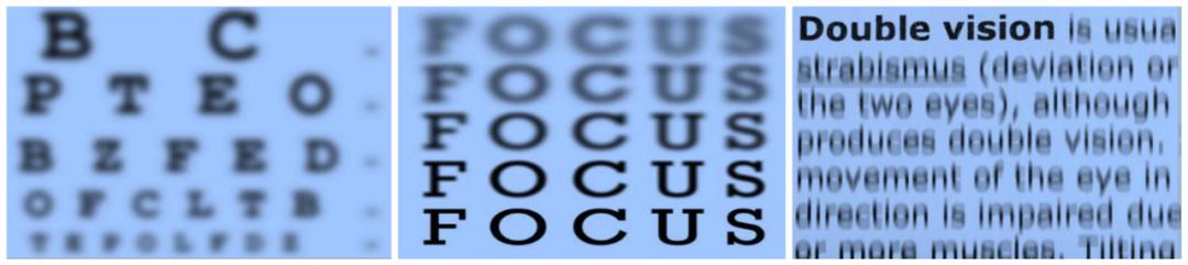 为你拼“睛”全力的Ta，是时候该歇歇了