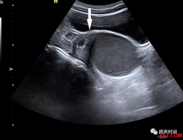 典型处女座高冷文案,典型处女座特征