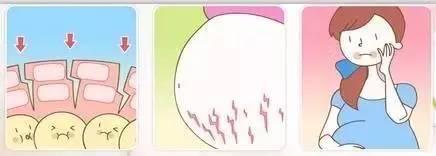 怀孕长妊娠纹怎么办？妊娠纹有效修复方法介绍