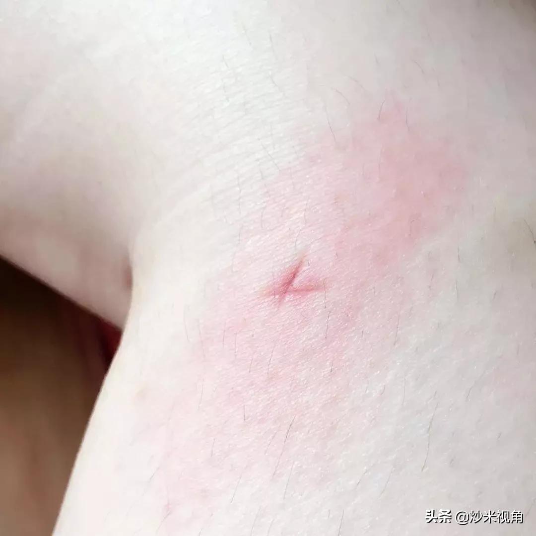 开车晕车犯困怎样快速清醒,开车犯困一招搞定