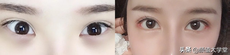 歌手黄霄云整容过吗,黄霄云参加歌手淘汰了谁