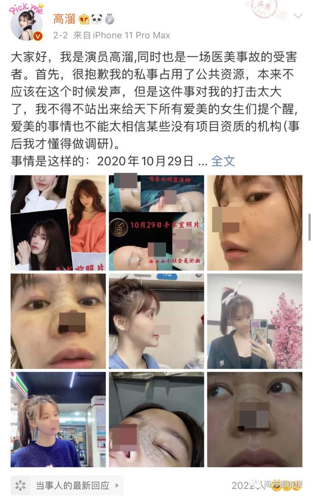 女明星整容失败案例电视剧,盘点那些整容失败案例的女演员