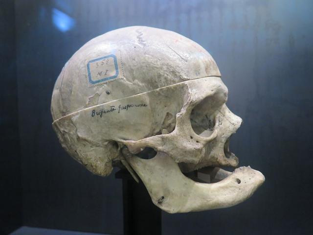 判断犯罪者的面相,面相判断犯罪人的标准有哪些