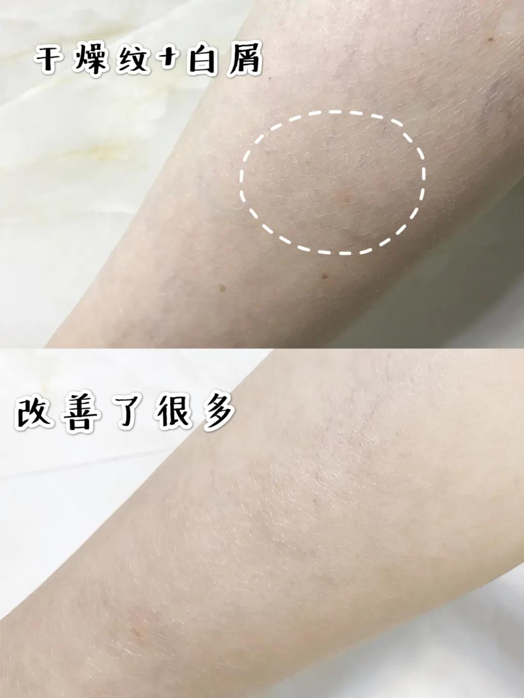 可以spa的增压花洒,增压除氯花洒