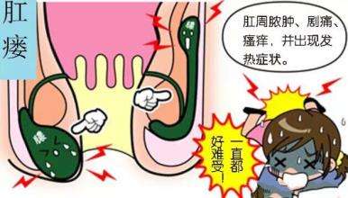 关于肛瘘的故事简短,关于肛瘘的症状及治疗方法