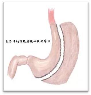 虚胖和实胖怎么减肥,实胖虚胖一起解决