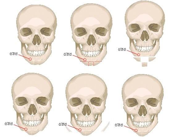 10个瘦脸小妙招如何快速瘦脸,脸肥怎么运动瘦脸最快最有效