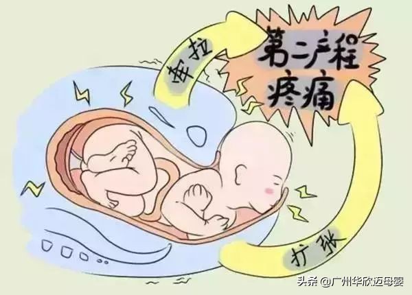 剖腹产想剖就能剖？还要这些医学指征呢