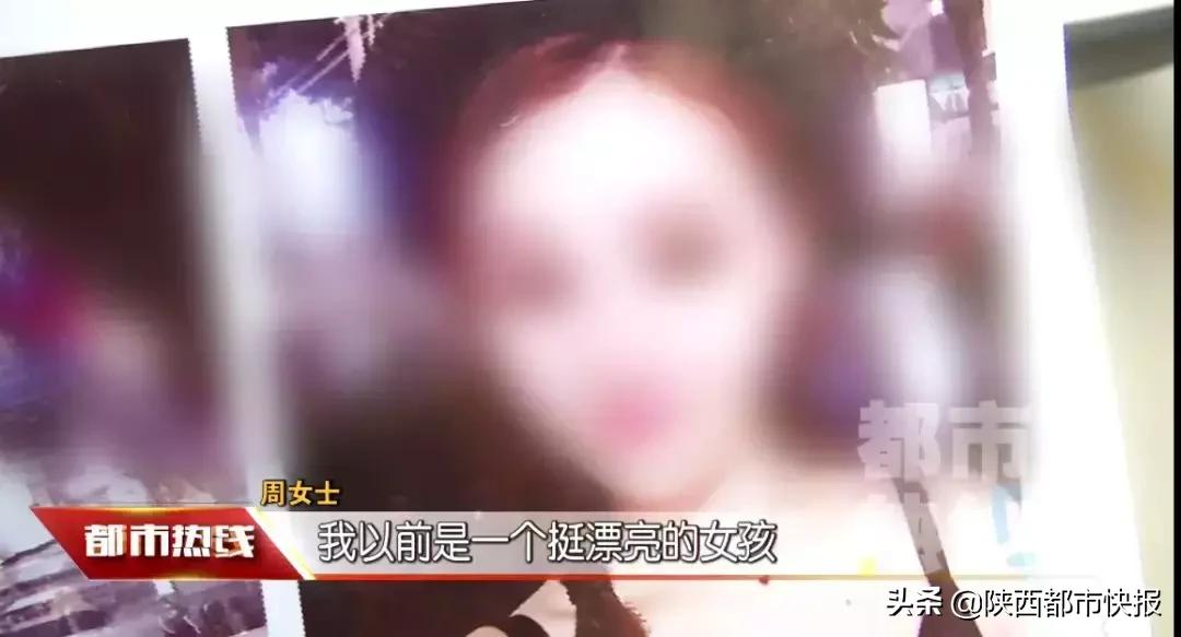 女子打童颜针修复,一女子打瘦脸针毁容